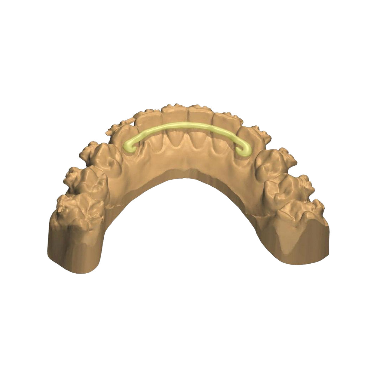 Retainer full digital con dima di posizionamento