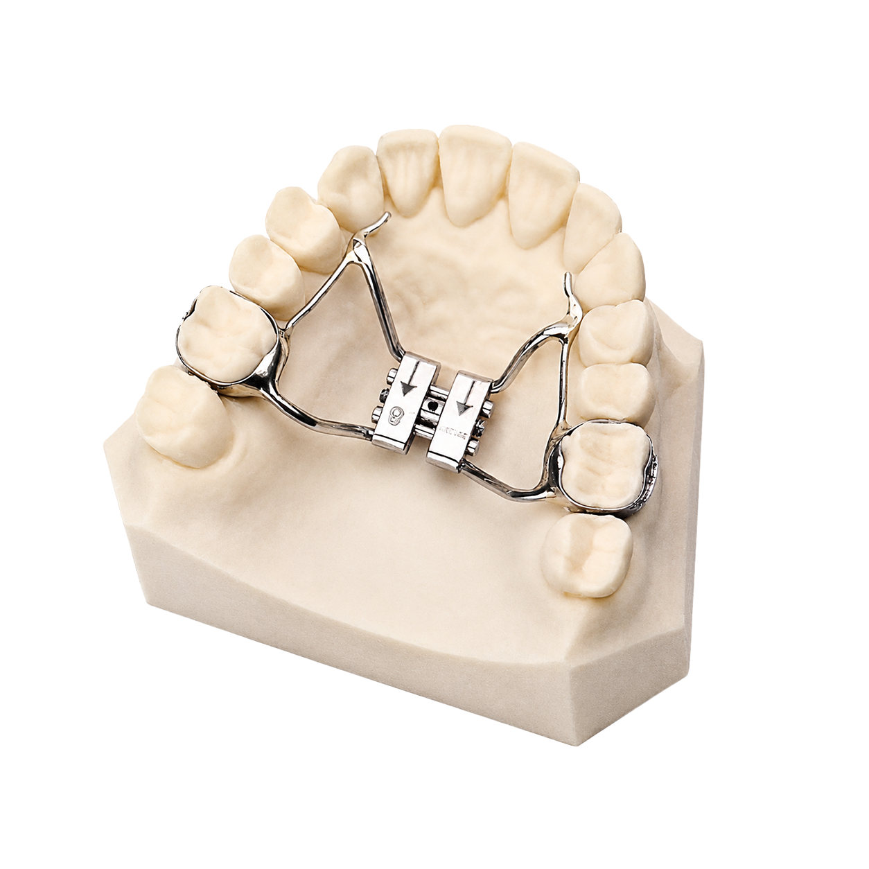 Espansore rapido del palato – Smileline Fast Block | Contenzioni su ...