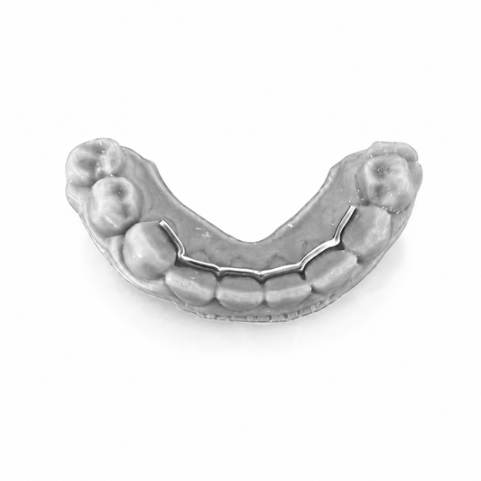 Retainer full digital con dima di posizionamento